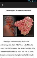 Deep Vein Thrombosis captura de pantalla 3