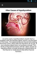 Hypothyroidism Symptoms capture d'écran 2