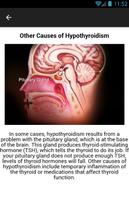 Hypothyroidism Symptoms screenshot 2