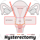 Hysterectomy APK