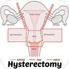 Hysterectomy icône