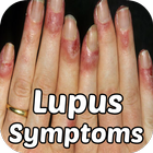 Lupus icône