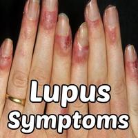 Lupus Affiche