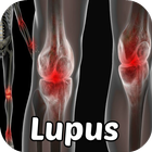 Lupus Symptoms Disease 아이콘