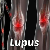 Lupus Symptoms Disease 海报