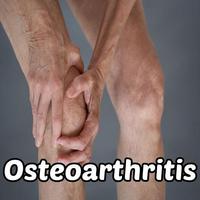 Osteoarthritis Symptoms Affiche