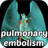 Pulmonary Embolism Symptoms 아이콘
