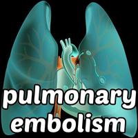 Pulmonary Embolism Symptoms Affiche