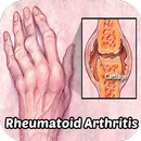 Rheumatoid Arthritis APK