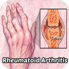 Rheumatoid Arthritis simgesi