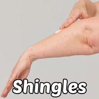 Shingles gönderen