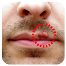 Cold Sores APK