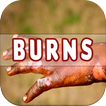 Burns: Causes, Diagnosis, and 