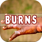 Burns: Causes, Diagnosis, and  icon
