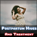 Dealing Postpartum Hives APK