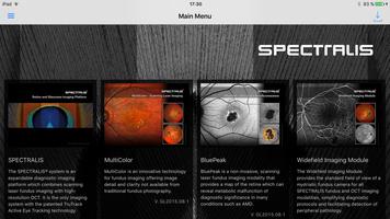 SPECTRALIS OCT US الملصق