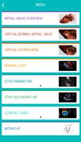 Mitral View স্ক্রিনশট 1