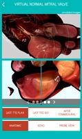 Mitral View স্ক্রিনশট 2
