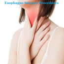 Esophagus Surgery Procedures APK