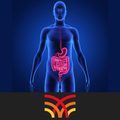CT Abdomen