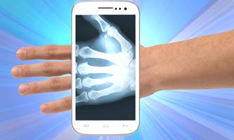 X Rays Smartphone Joke syot layar 1