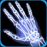 X Rays Smartphone Joke syot layar 2