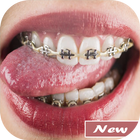 Braces Teeth Selfie آئیکن