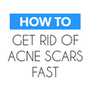 Get Rid of Acne Scars Fast‏‎ APK