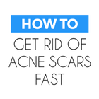 Get Rid of Acne Scars Fast‏‎ icon
