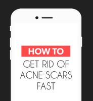 Get Rid of Acne Scars Fast‏‎ screenshot 3