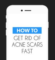 Get Rid of Acne Scars Fast‏‎ poster