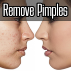 How to Remove Pimples 图标