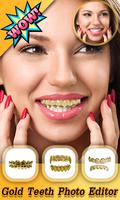 Gold Teeth Photo Editor Cartaz