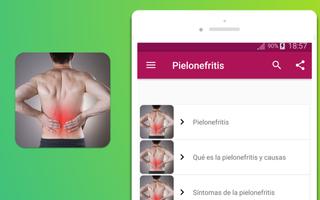 Pielonefritis 스크린샷 3