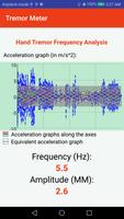 Digital Hand Tremor Meter screenshot 1
