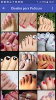 Pedicure 스크린샷 1