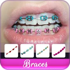 Braces Colors Beauty