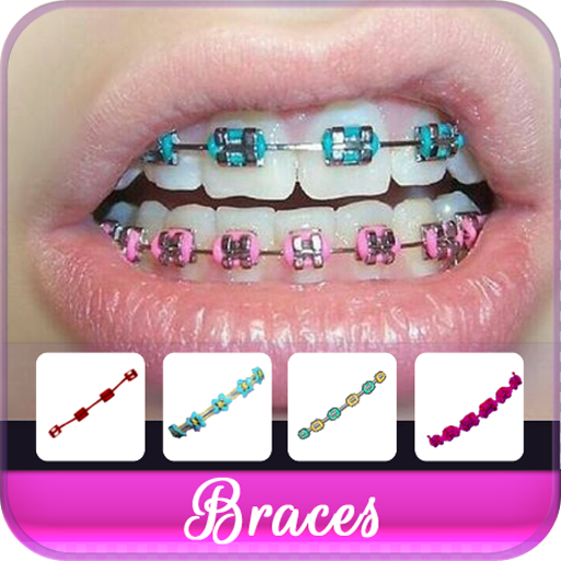 Braces Colors Beauty