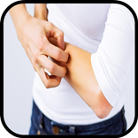 وصفات لعلاج الحكة في الجسم