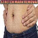 Natural Stretch Marks Removal APK