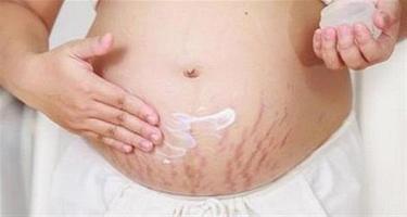 Natural Stretch Marks Removal capture d'écran 3