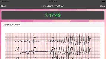 ECG Master: Quiz & Practice اسکرین شاٹ 1