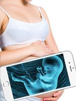 Ultrasound Scanner Sonography Affiche