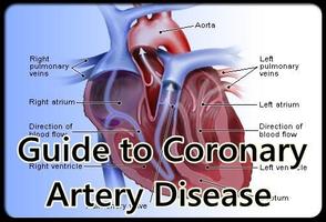 Guide Coronary Artery Disease capture d'écran 1