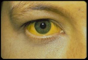 برنامه‌نما Guide to Hepatitis عکس از صفحه