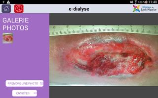 E-Dialyse capture d'écran 1