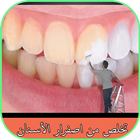 تخلص من اصفرار الأسنان ikon