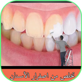 تخلص من اصفرار الأسنان иконка