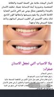 تخلص من اصفرار الأسنان plakat