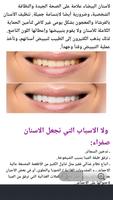 تخلص من اصفرار الأسنان bài đăng